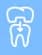 Root Canal Treatment